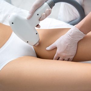 depilação íntima a laser