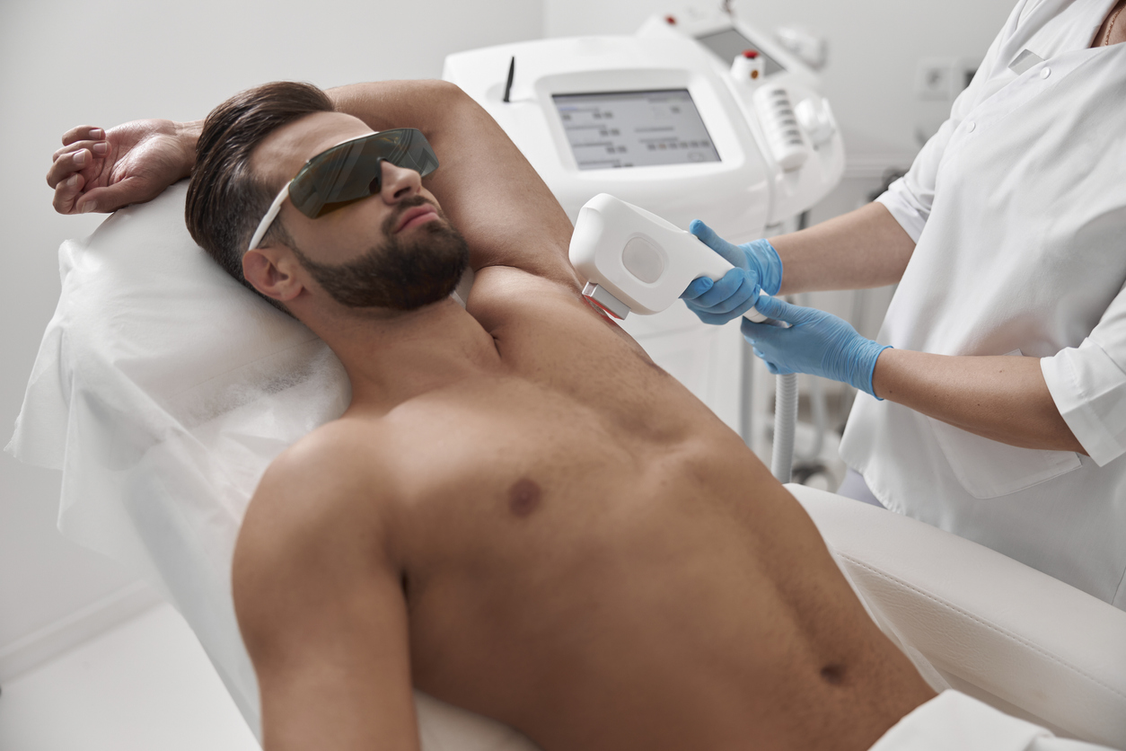 depilação a laser masculina